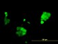 PGR Antibody (monoclonal) (M04)